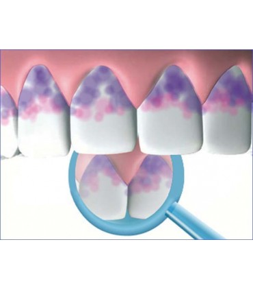 MIRADENT I PROX CARE SET - SET INGRIJIRE INTERDENTARA