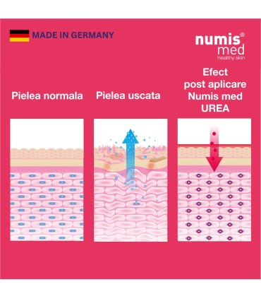 Numis Med - UREA - Crema faciala de zi cu 5% uree si acid hialuronic, 50ml