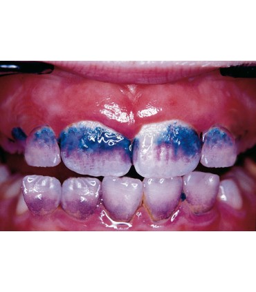 Miradent - MIRA 2-TON -TABLETE PT.CONTROLUL PLACII BACTERIENE, 6 tablete